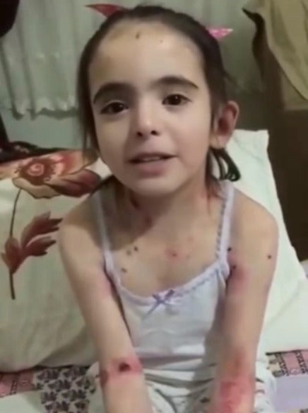 Help Laura Live With Less Pain and More Hope